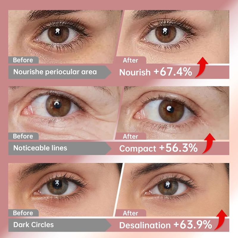 Eye Mask with Collagen Peptide, PDRN, Retinol & Niacinamide