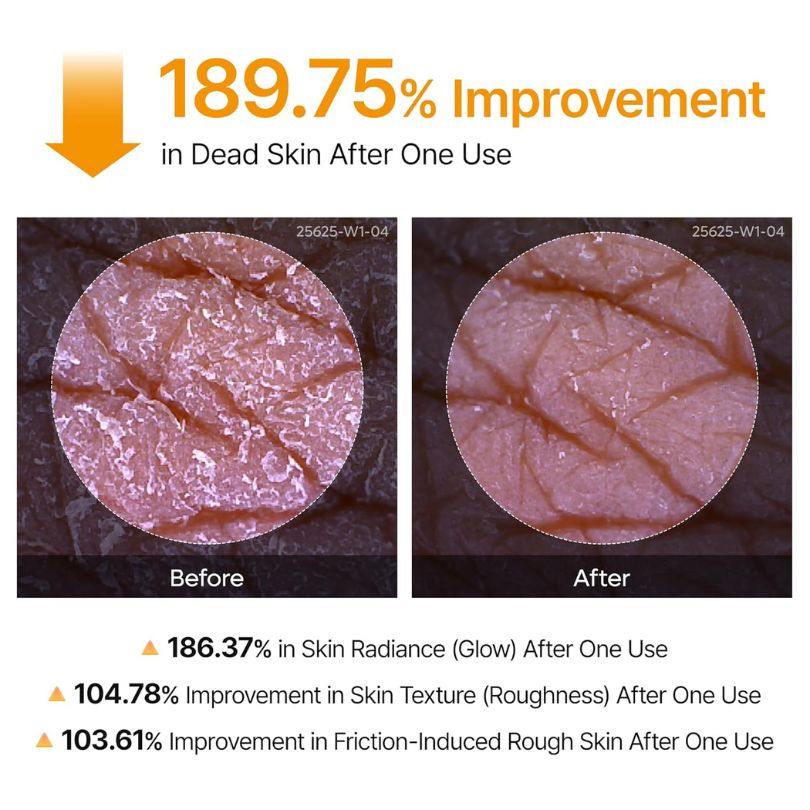 Glow Haven – Radiance Peel Shot Spray