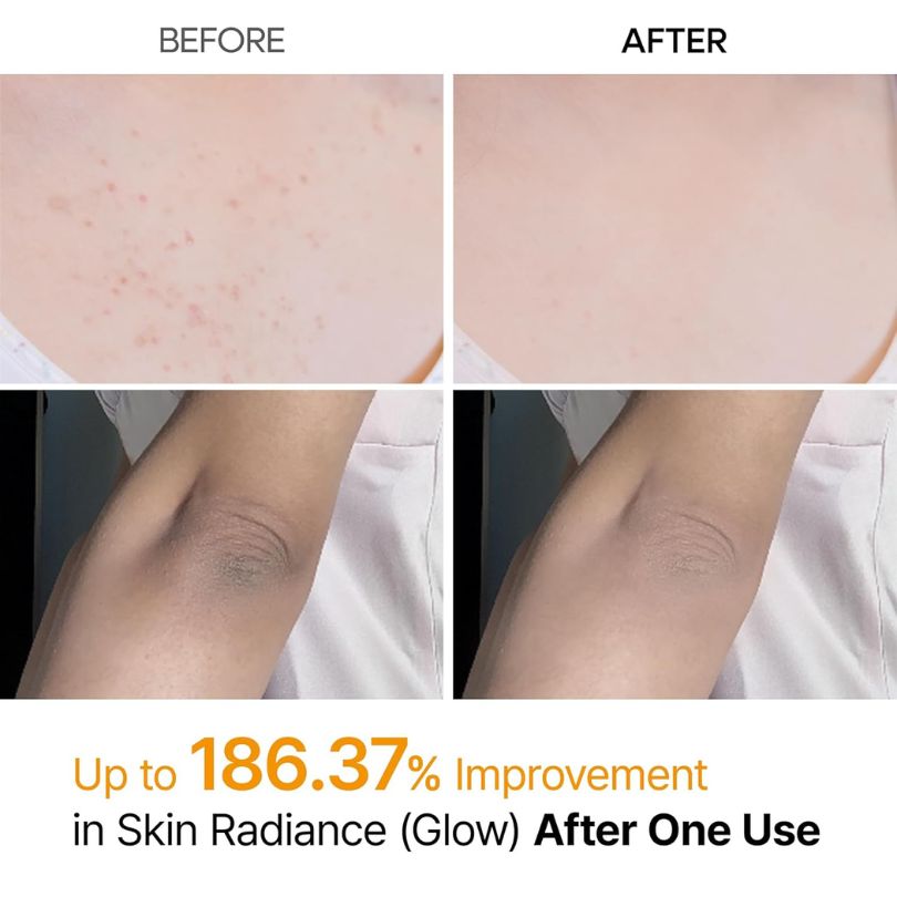 Glow Haven – Radiance Peel Shot Spray