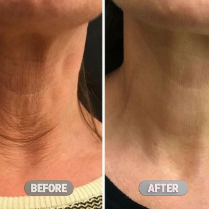 Necksphalt ECM Barrier Ampoule - Anti-Aging Neck