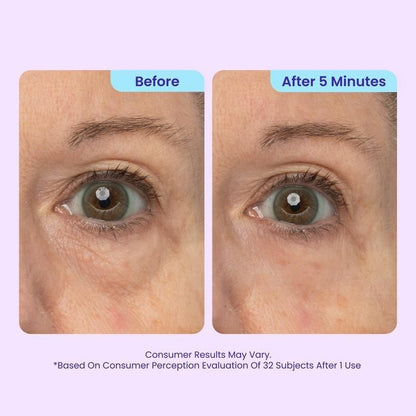 Instant Lift Eye Gel - For Puffiness & Bags