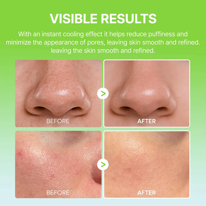 Cactox Pore Multi Balm - Reduce Puffiness & Pore Tightening