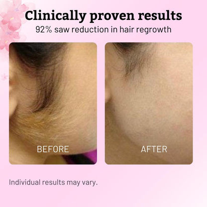 Permanent Hair Reduction Oil