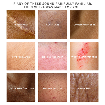 Silicone Scar Stick By Glow Heaven